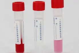 核酸检测管里的红色液体是什么？为啥是红色的？图片