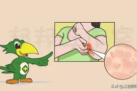 带你了解不同类型的荨麻疹图片