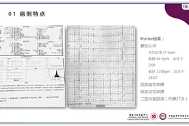 突破心律失常药物治疗瓶颈 临床典型病例提升诊疗质量图片