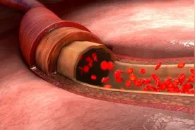 两个小动作，测出你的血管是否健康，快来试试看图片