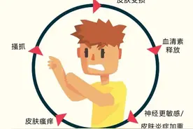 身上痒一抓就烂结痂，结痂了还是痒，一直想去抓图片