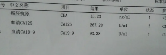 医生带你解读肿瘤标志物——ca125