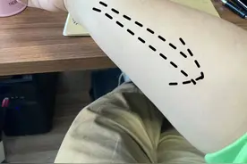 孩子高烧不要怕，7个实用经验快速降温，“小阳人”护理心得图片