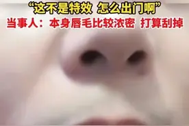 女子感染新冠后长出浓密胡子，当事人：这不是特效，打算刮掉图片