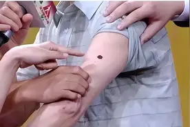 皮肤是疾病的“照妖镜”！出现这些斑点，可能是身体在喊救命图片