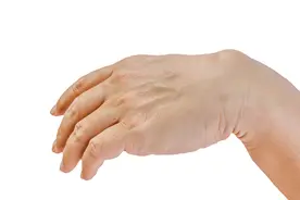 手上有青筋，或隐藏疾病，手部这4个部位有青筋，要注意图片