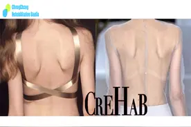 背部翘起的肩胛骨，还是你苦苦追寻的美背吗？——翼狀肩胛图片