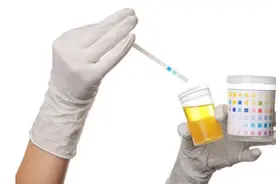 服用达格列净，尿糖阳性，是不是药没效果？图片