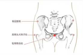 怀孕期间屁屁痛，是怎么一回事？怎样才能缓解？图片
