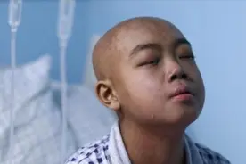 “沉默的杀手”——再生障碍性贫血图片