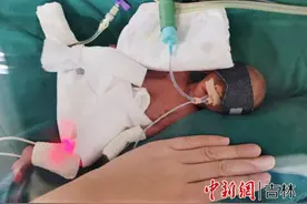出生不到1斤！长春一名超早早产儿平安出院！图片