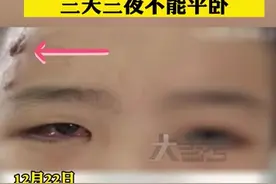 （视频）@太原人！长痘痘千万别乱挤！13岁女孩挤痘痘诱发败血症图片
