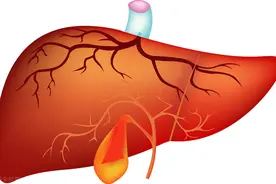 胆囊切除后，有哪些后遗症？提醒：这5种“结局”不好受，了解下图片
