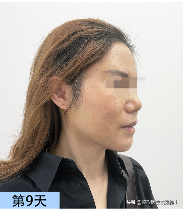 47岁一个人从成都跑北京做小拉皮，9天过去了，像变了一个人