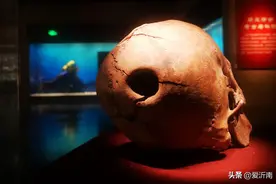 古代中医会做“外科手术”吗？比你想象的先进多了！图片