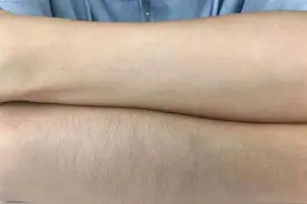 女性这3处毛发旺盛，会有哪些好处？多数人或许不了解图片