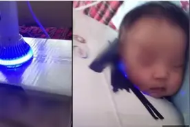 黄疸宝宝一旦出现3种变化，说明可能有核黄疸，要抓紧时间降黄疸图片