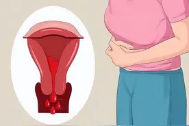 女生来例假时，突然流出的一股血块，是身上的肉吗？看完涨知识了图片
