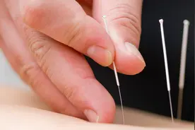 普通人学针灸，从小白到临床高手，这四个层次要知道图片