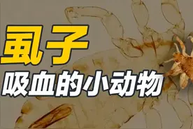 这三种虱子只寄生人类！一旦感染很难摆脱图片