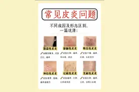 春季皮肤“闹情绪”？6种常见皮炎大揭秘：对症下药是关键！图片