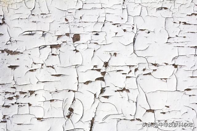 去鸡皮蛇皮鱼鳞皮肤的