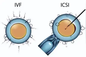 我做了ICSI，怎么还是不受精？图片