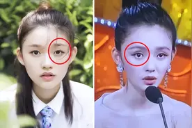 眼窝凹陷才是“毁容利器”，堪称女明星的“颜值杀手”图片