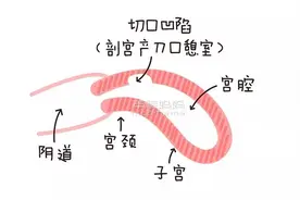 想生三胎，医生却说：最好不要再生了！图片