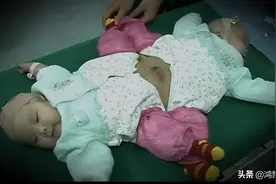2009年湖北产妇生下连体双胞胎，孩子性别难辨，医生看后摆了摆手图片