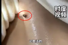 2岁男童被虫子吸血5天进医院！身上这种「小黑点」千万别大意！图片