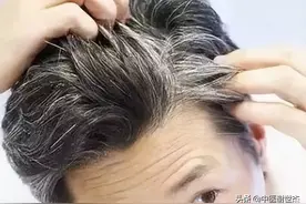 治疗白发血虚肾亏的八款中成药，让你恢复满头乌发，重返年轻图片