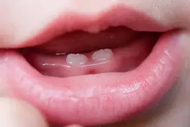 宝宝正确出牙时间和出牙顺序，看看你家娃“长对”没？图片