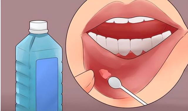 一瓶小小的维生素B12，或能“改善”6种病症，早知早受益