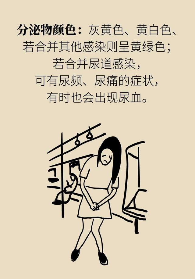 滴虫性阴道炎是很严重的妇科病吗？会不会传染？