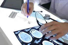 折磨人的偏头痛到底是怎么引起的？和脑梗有关吗？你关心的都在这图片