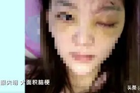 医美速成班被315晚会点名，涉事机构：合法合规，目前正常上课，学期8天包教会图片