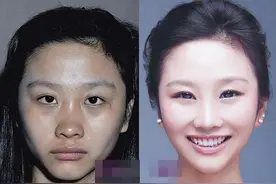 “整容成功”的4位女星！明明不知动过多少刀，但却毫无痕迹图片