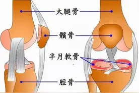 膝盖不舒服、痛到底是什么病？这里有6种诊断和康复方法图片
