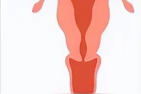 七种子宫形状，你了解过吗？图片