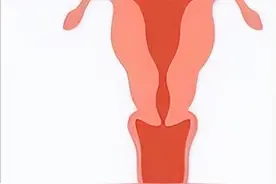 七种子宫形状，你了解过吗？图片