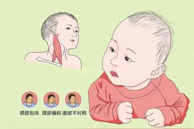 宝宝歪脖子？治疗要趁早图片