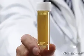 排尿黄、异味大？老中医：可能身体出现了这3个问题，千万别大意图片