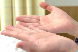 手汗症居然要看胸外科？没错！图片