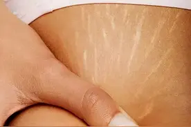 皮肤上的纹路到底怎么回事？图片