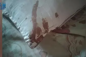 男子熟睡时疑被老鼠咬破头# ：已去亲友家领养猫咪图片