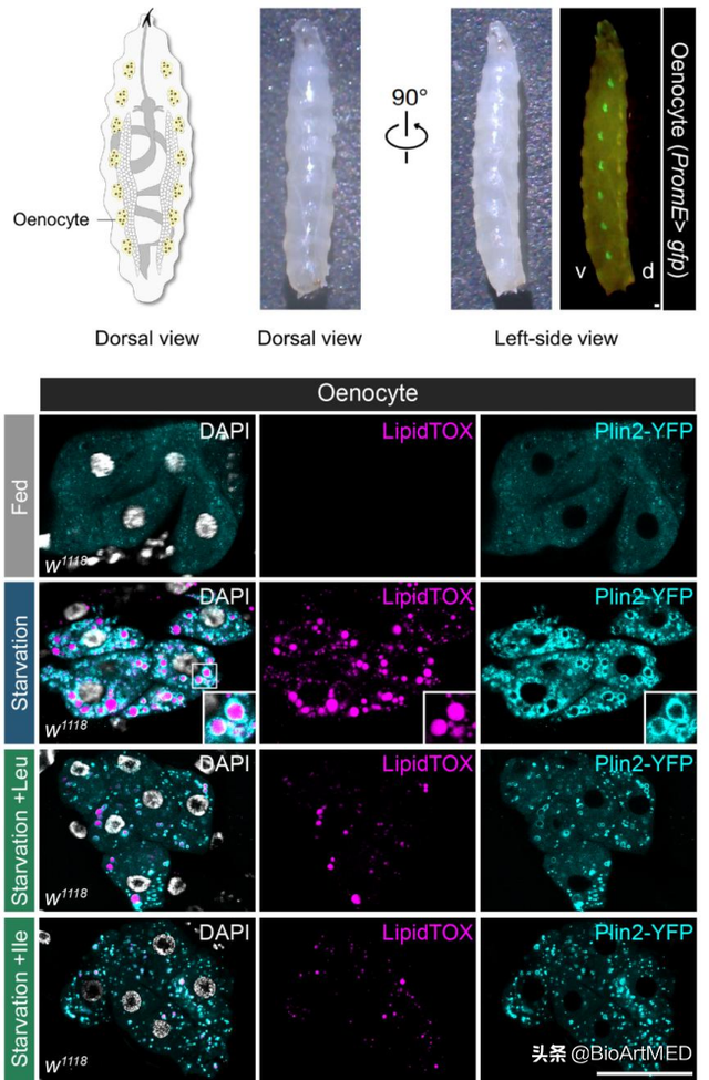 朱健课题组揭示必需氨基酸抵御脂肪肝病的作用机制