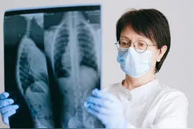 得了小细胞肺癌就“插翅难逃”了？不要自己吓自己图片