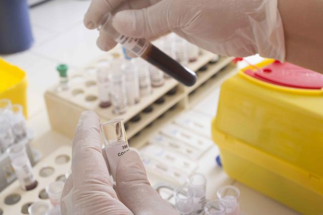 转氨酶升高代表什么？为何它会升高？多半与4个因素有关，别忽视