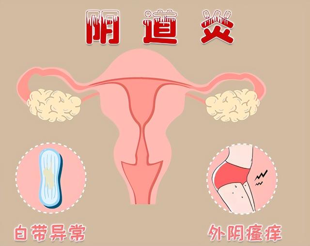 区分宫颈病变,还需掌握这3个"标识"(阴到炎症的症状) - 趣测网